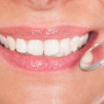Como cuidar el esmalte dental
