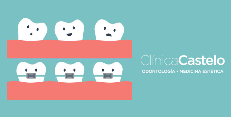 Diferentes Tipos De Ortodoncia Para Tus Necesidades