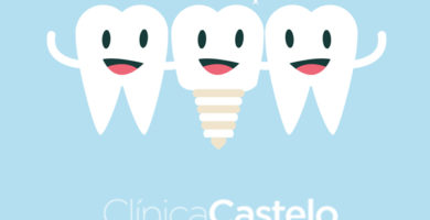 qué son los implantes dentales-castelo-dest