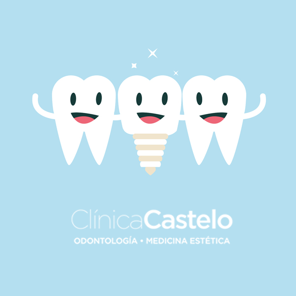 qué son los implantes dentales-castelo-dest