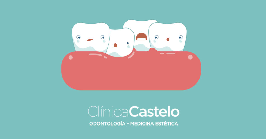 que es la ortodoncia interceptiva-Castelo