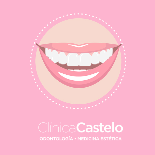 ortodoncia invisible en Madrid-clinica castelo-dest