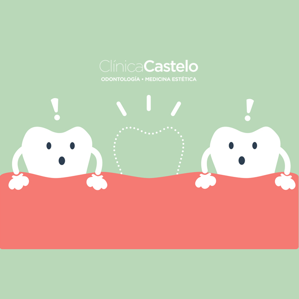 prótesis removible sobre dientes-clinica castelo-dest