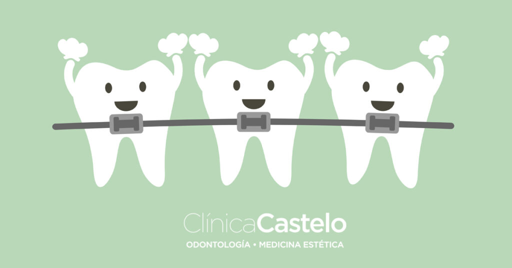 tratamiento de ortodoncia-clínica castelo