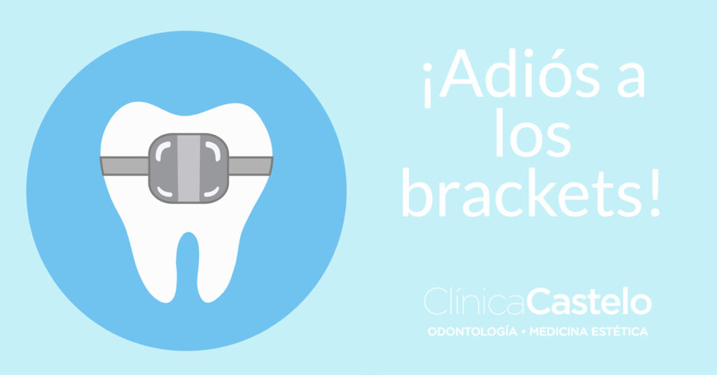 cómo tener dientes perfectos-clinica castelo
