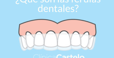 qué son las férulas dentales-clinica castelo-dest