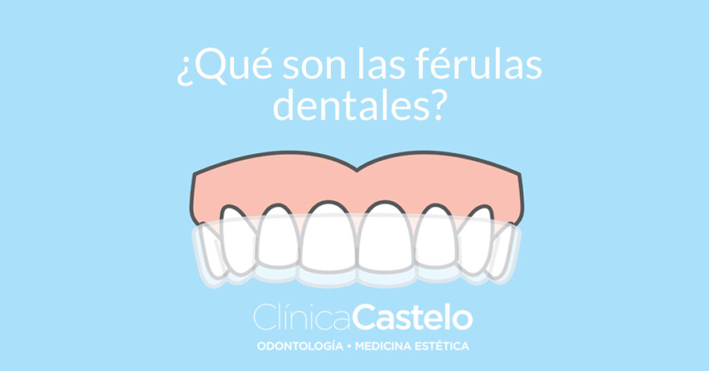 ¿que son las férulas dentales-clínica castelo