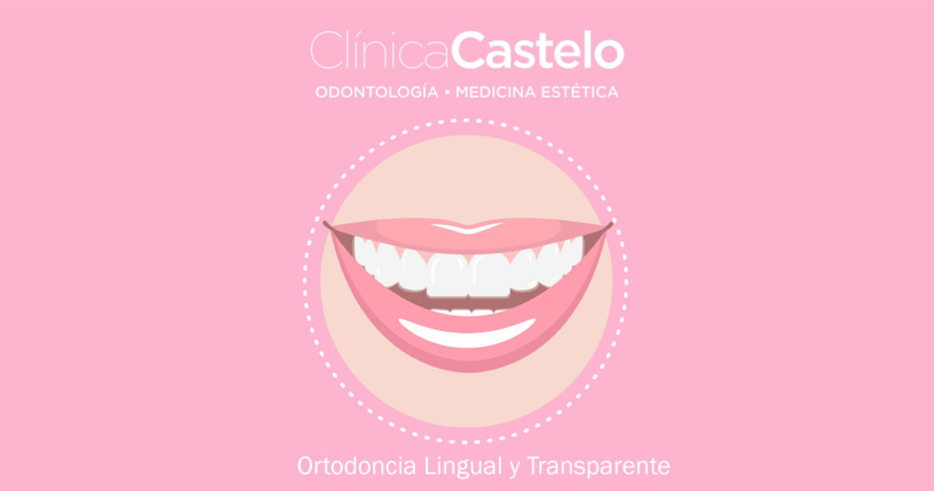 ortodoncia lingual 