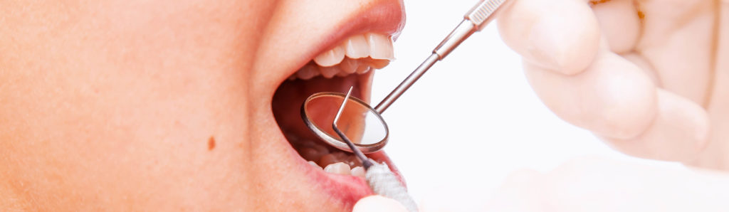 Gingivitis y periodontitis