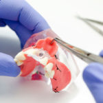 Regeneración ósea y cirugía periodontal