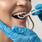 contorneado dental
