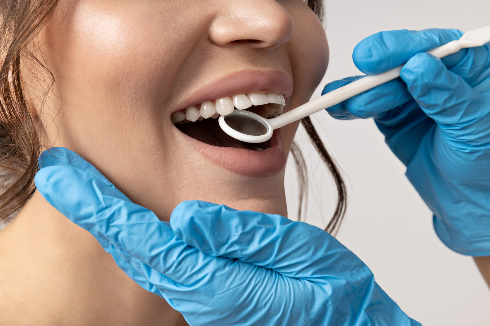 contorneado dental