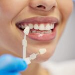 guía de color dental