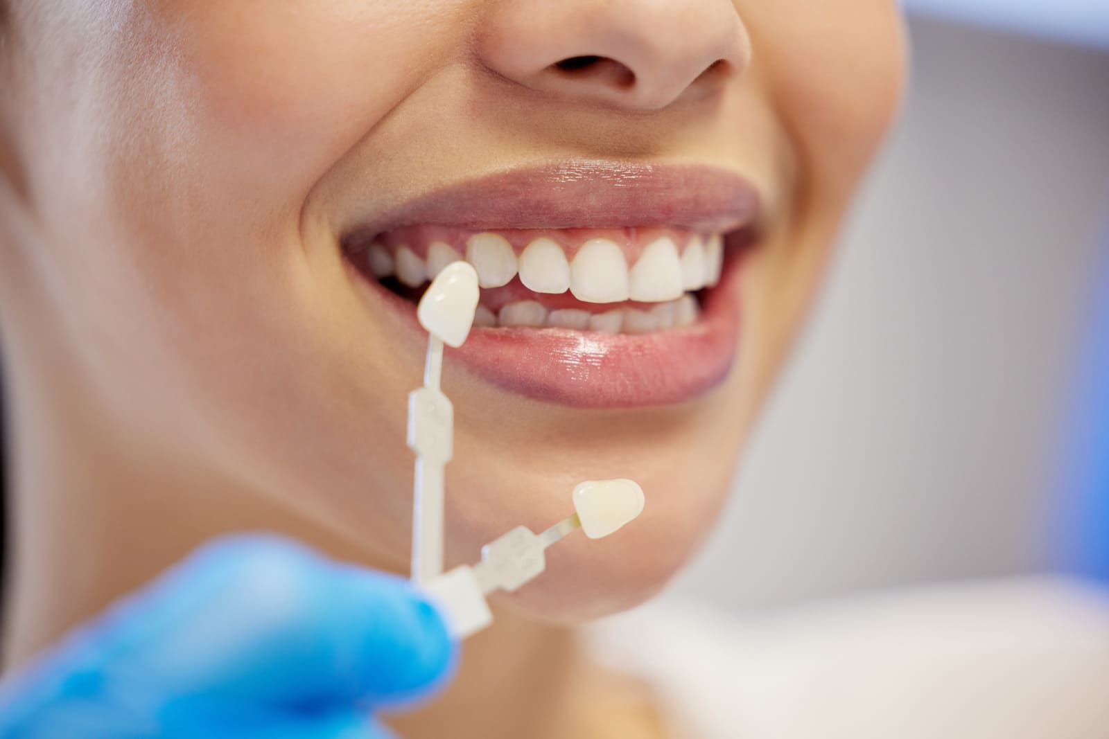 guía de color dental