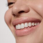 corregir diastema clinica castelo