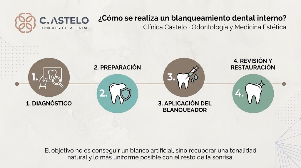 como se realiza un blanqueamiento dental interno clinica castelo