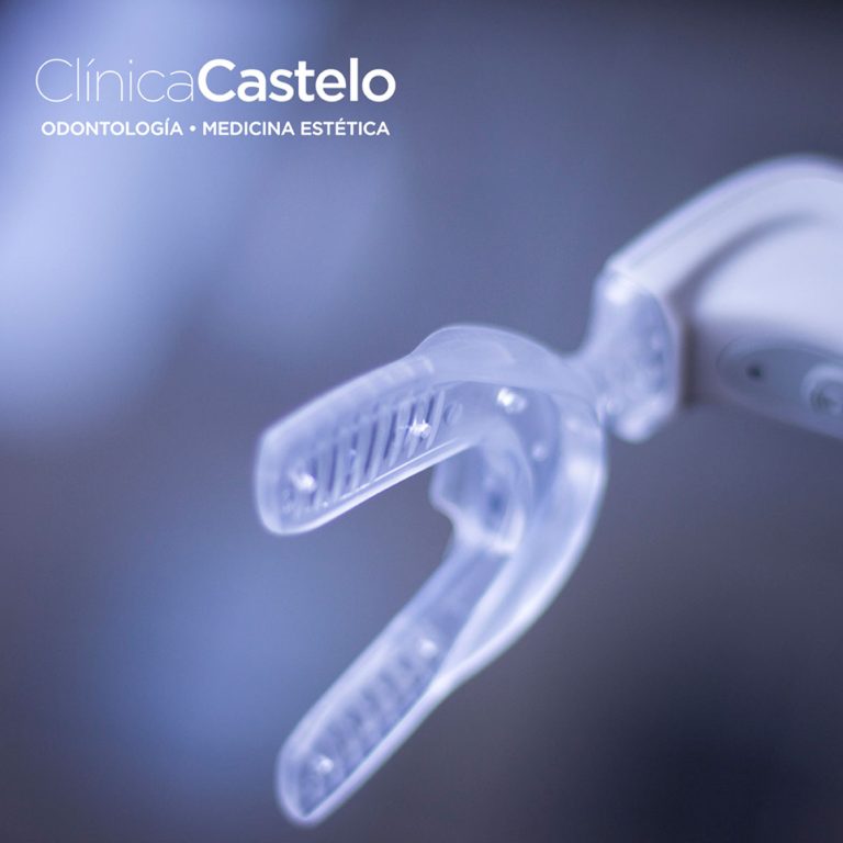 Acelerador de ortodonciaIG