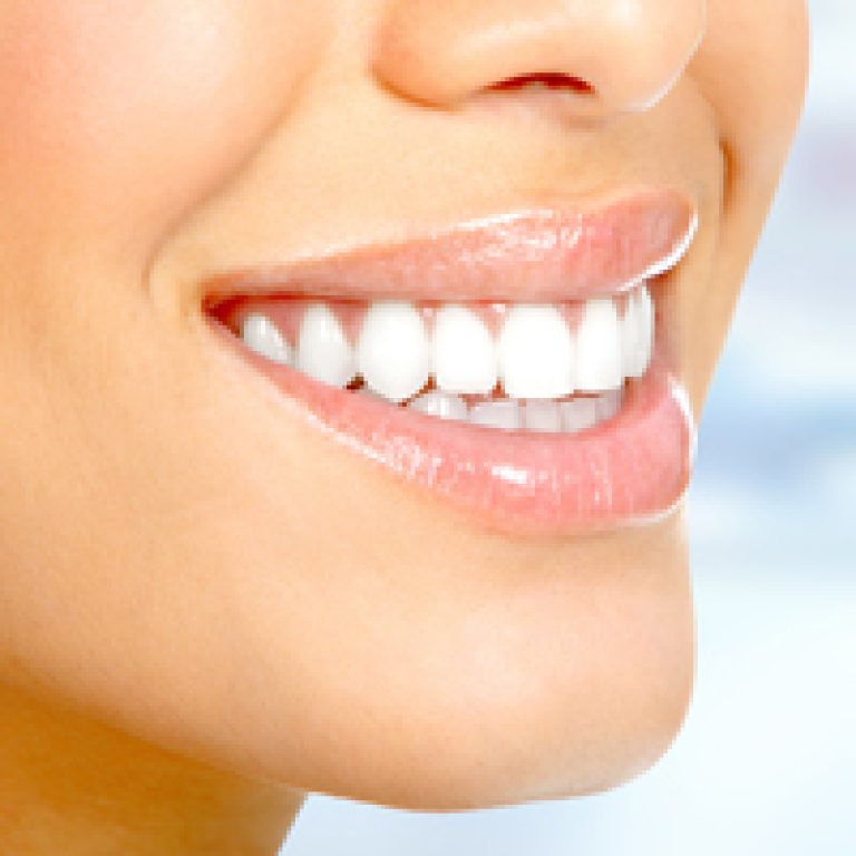 castelo-dentadura-cort