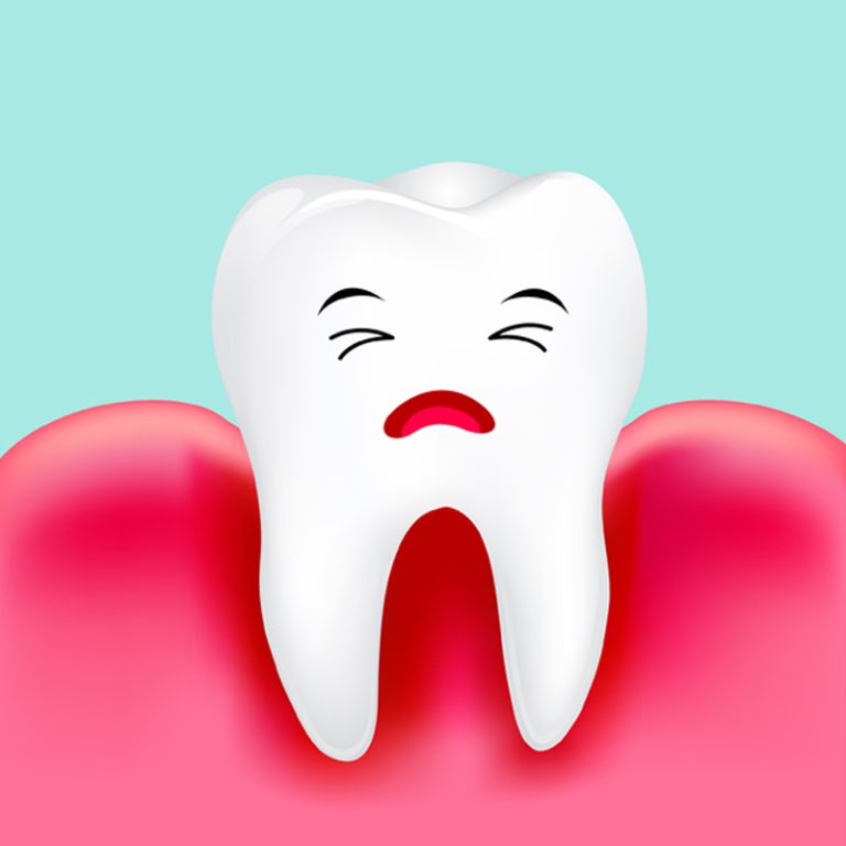 qué es la gingivitis-clínica castelo-dest