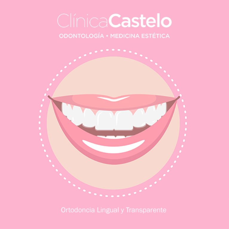 Ortodoncia Transparente