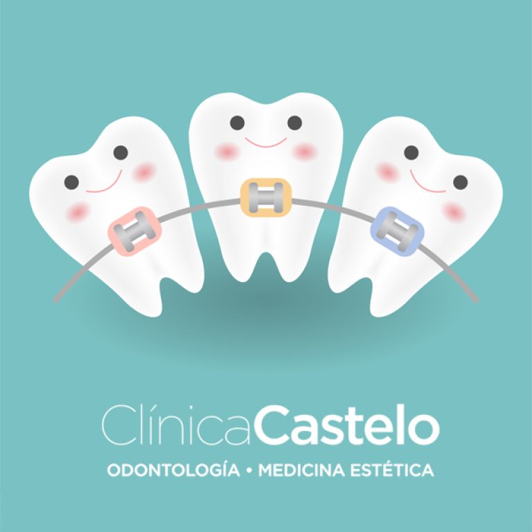 castelo-brackets autoligables-dest