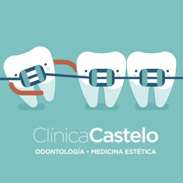 clinica ortodoncia madrid-clinica castelo-2