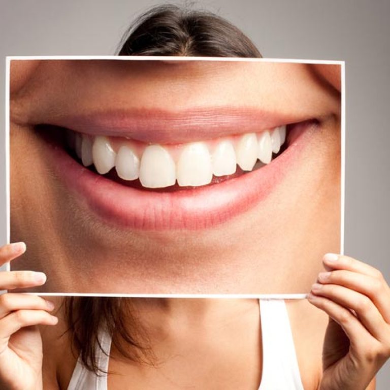 castelo-ortodoncia-invisible-incognito