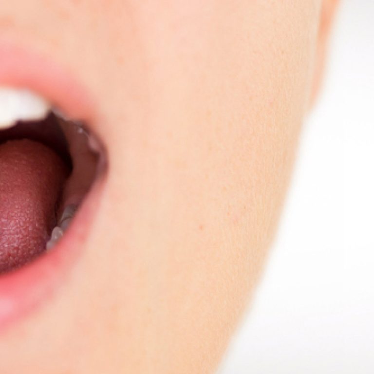 Retracción de las encías en Madrid