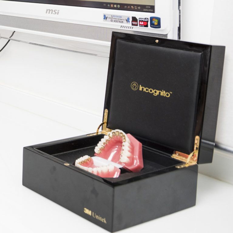 Ortodoncia para adultos. Ortodoncia de incógnito. Clínica Castelo. Madrid