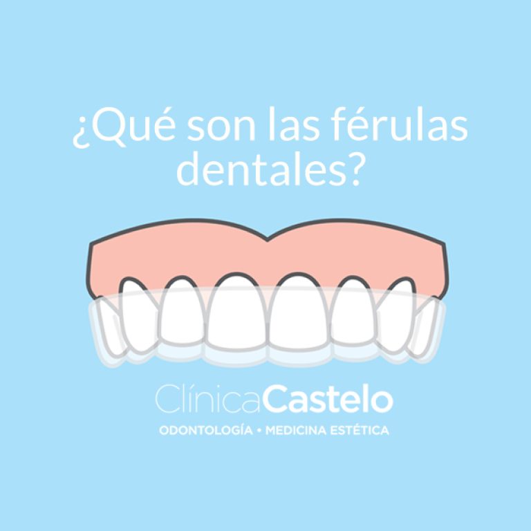 qué son las férulas dentales-clinica castelo-dest